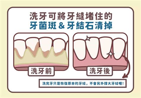 牙縫大面相|【牙縫大面相】牙縫大面相，讓你魅力爆棚，財運亨通，桃花旺盛。